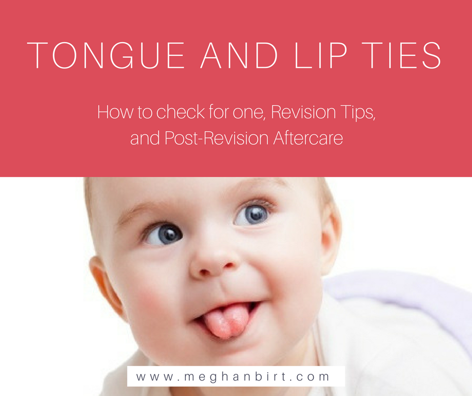 Lip and Tongue Ties: How to check for one, Revision Tips, and Post ...